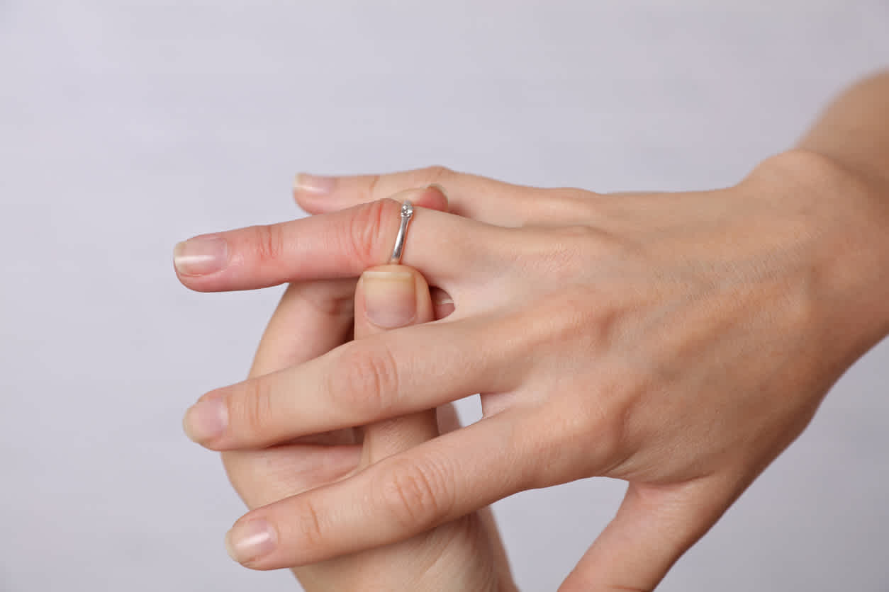 hand-with-a-ring-and-swollen-fingers